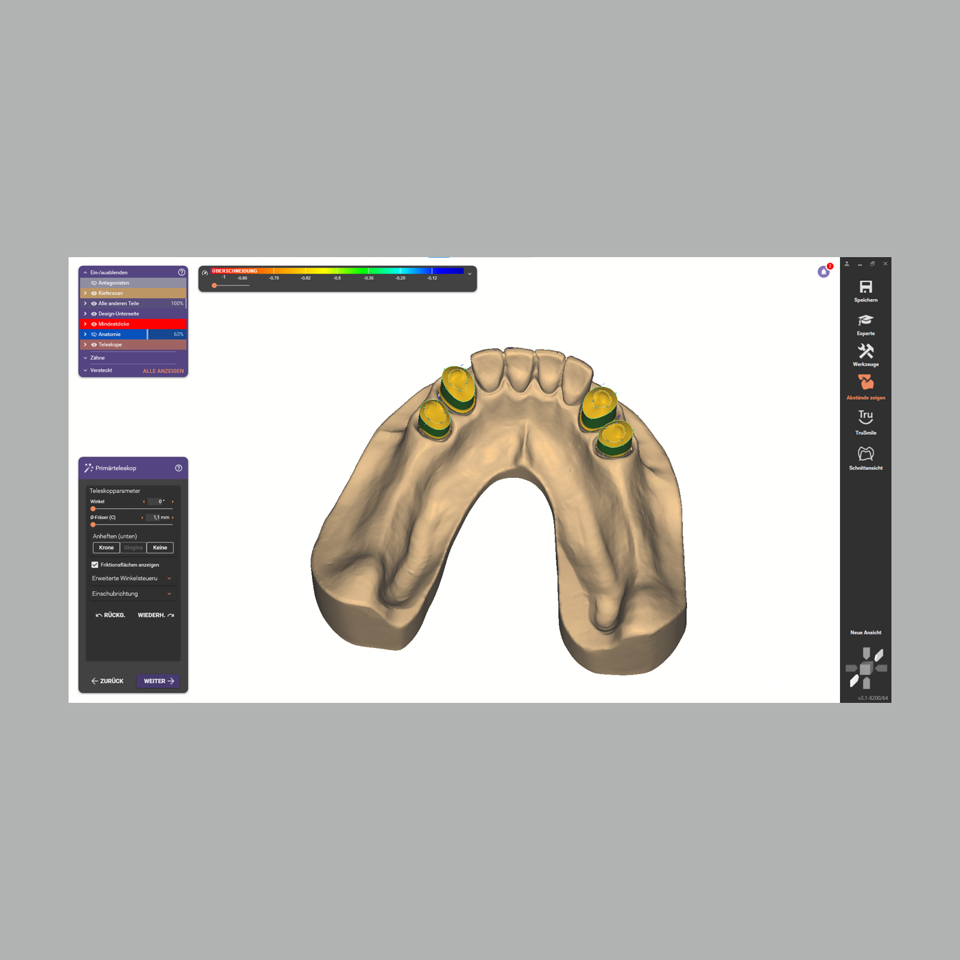 CAD/CAM