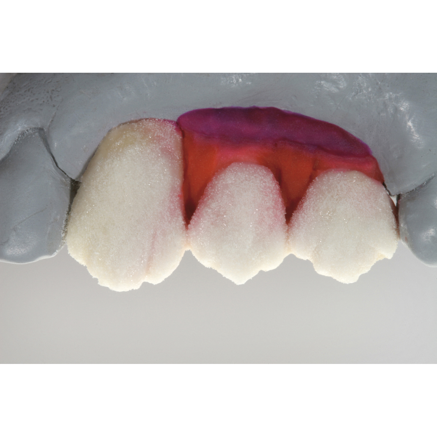 GC Initial MC gum shade powder opaque set