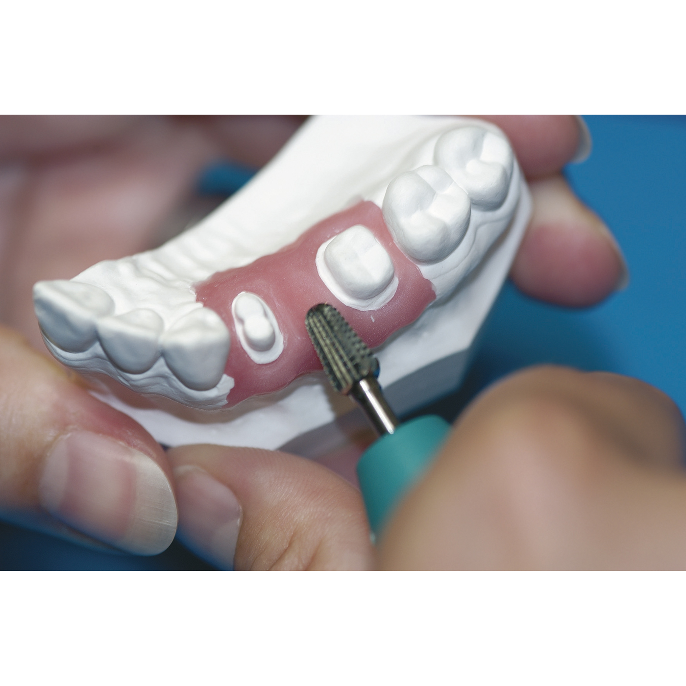 Coltène/Whaledent GiMask Automix New Formula Gingival Mask Material Refill